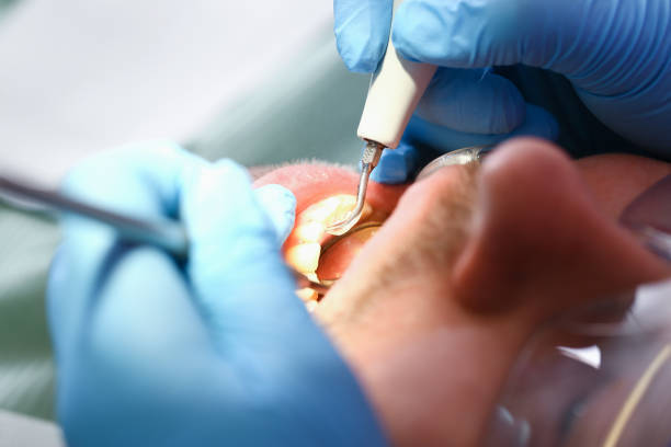 Best Emergency Treatment for Dental Infections or Abscesses in Lovington, NM